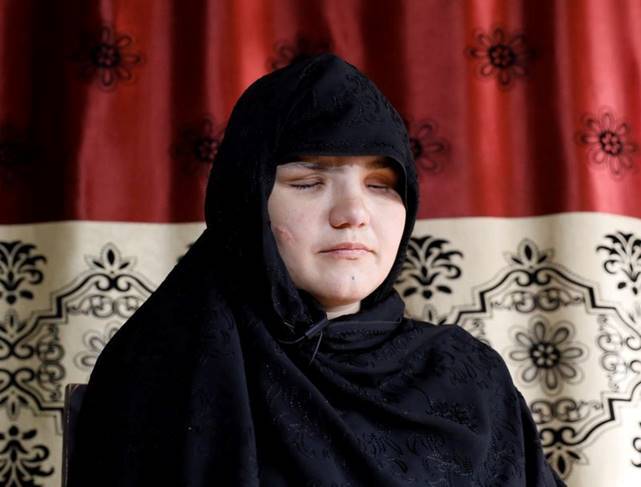 Khatera, 33, an Afghan police woman who was blinded after a gunmen attack in Ghazni province - REUTERS/Mohammad Ismail