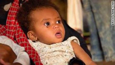 Issham is two years old, but has yet to take her first steps. Her family has received no food aid in weeks.